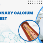 CT Coronary Calcium Score test