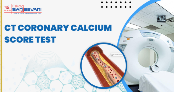 CT Coronary Calcium Score test