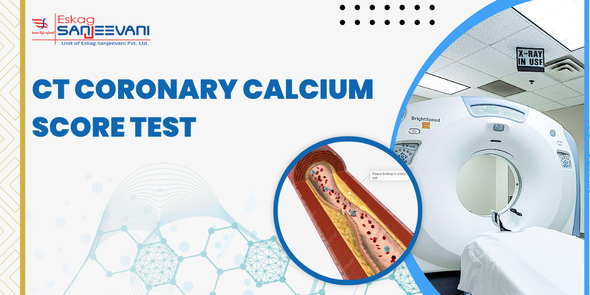 CT Coronary Calcium Score test