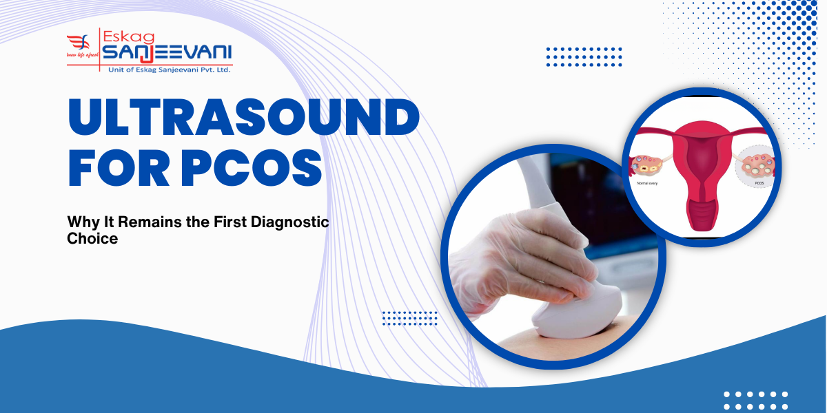 Ultrasound for PCOS