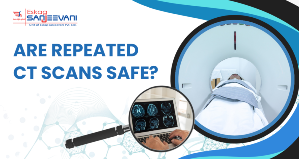 Safety of repeat CT scans