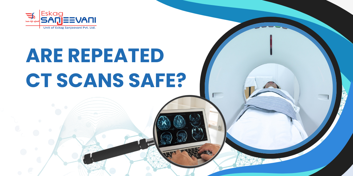 Safety of repeat CT scans