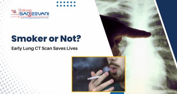 Smoker and Early Lung CT Scan