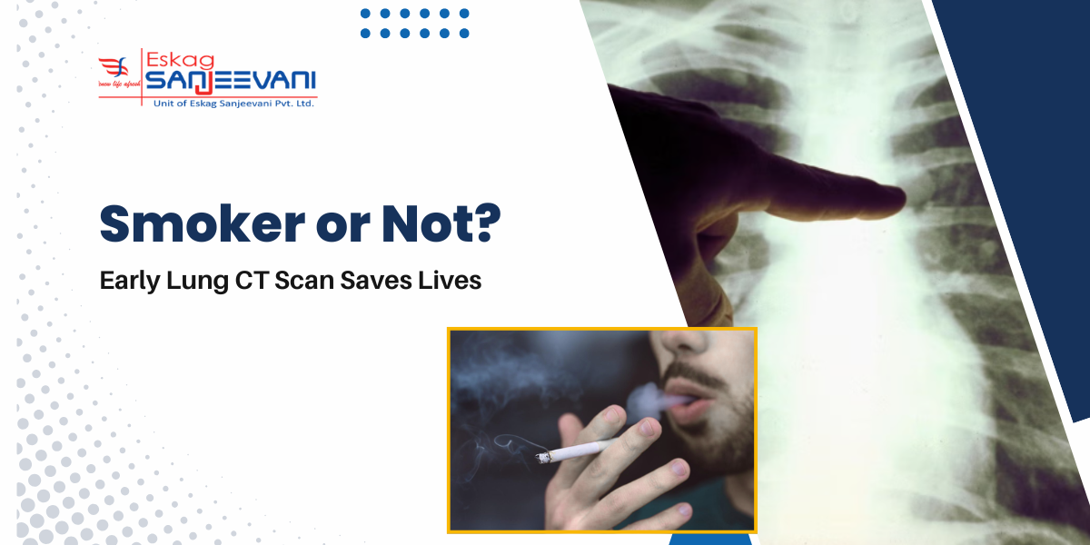 Smoker and Early Lung CT Scan