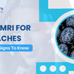 Brain MRI for Headaches