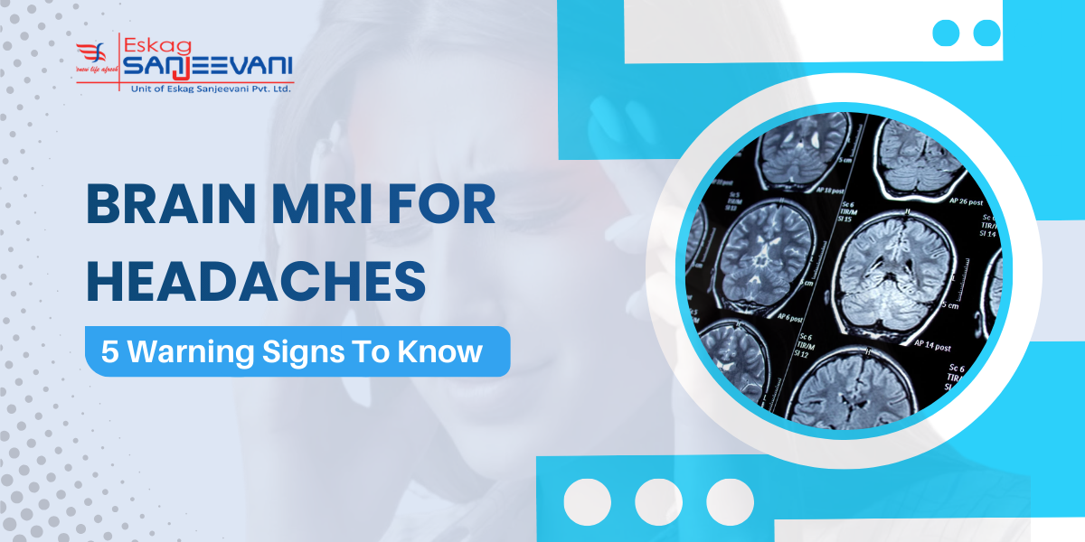 Brain MRI for Headaches