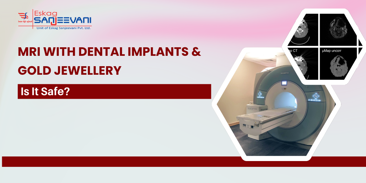 MRI With Dental Implants & Gold Jewellery