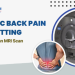 Chronic Back Pain from Sitting