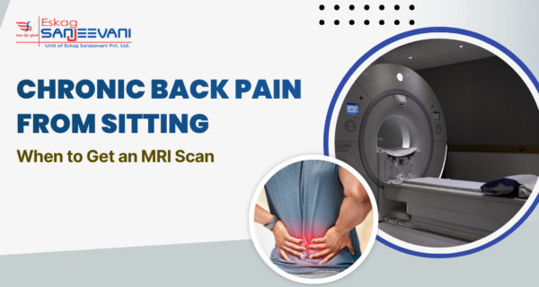 Chronic Back Pain from Sitting