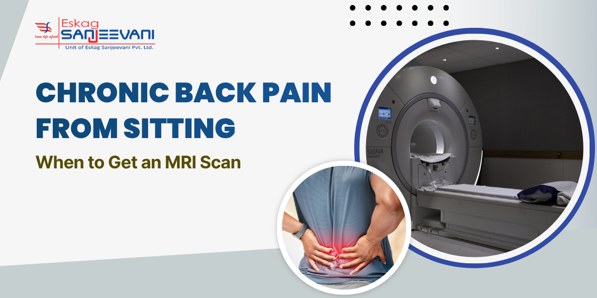 Chronic Back Pain from Sitting