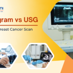 Mammogram vs USG
