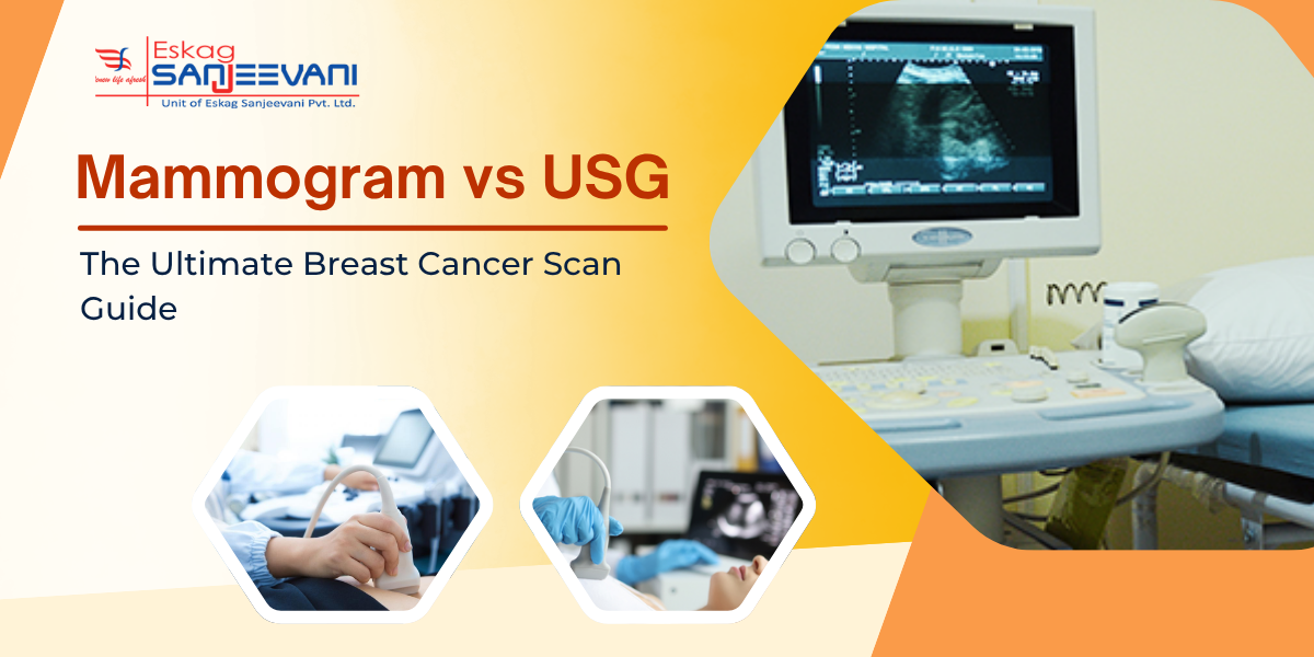 Mammogram vs USG