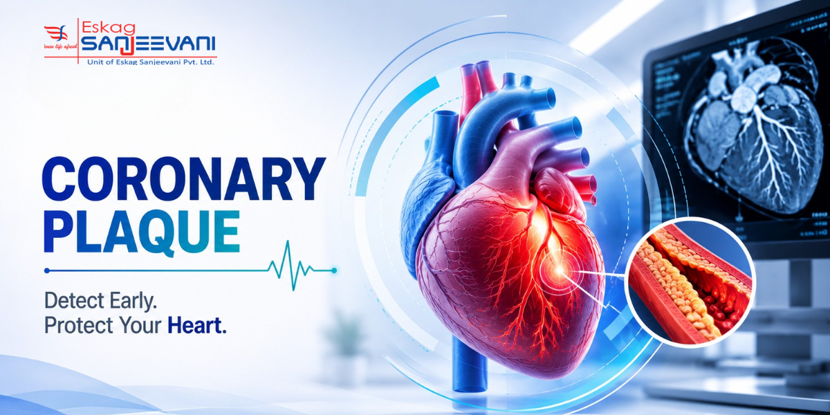 coronary plaque