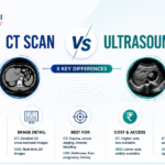 ct scan vs usg