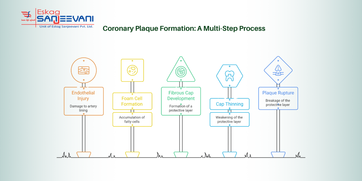 stepwise coronary plaque formation