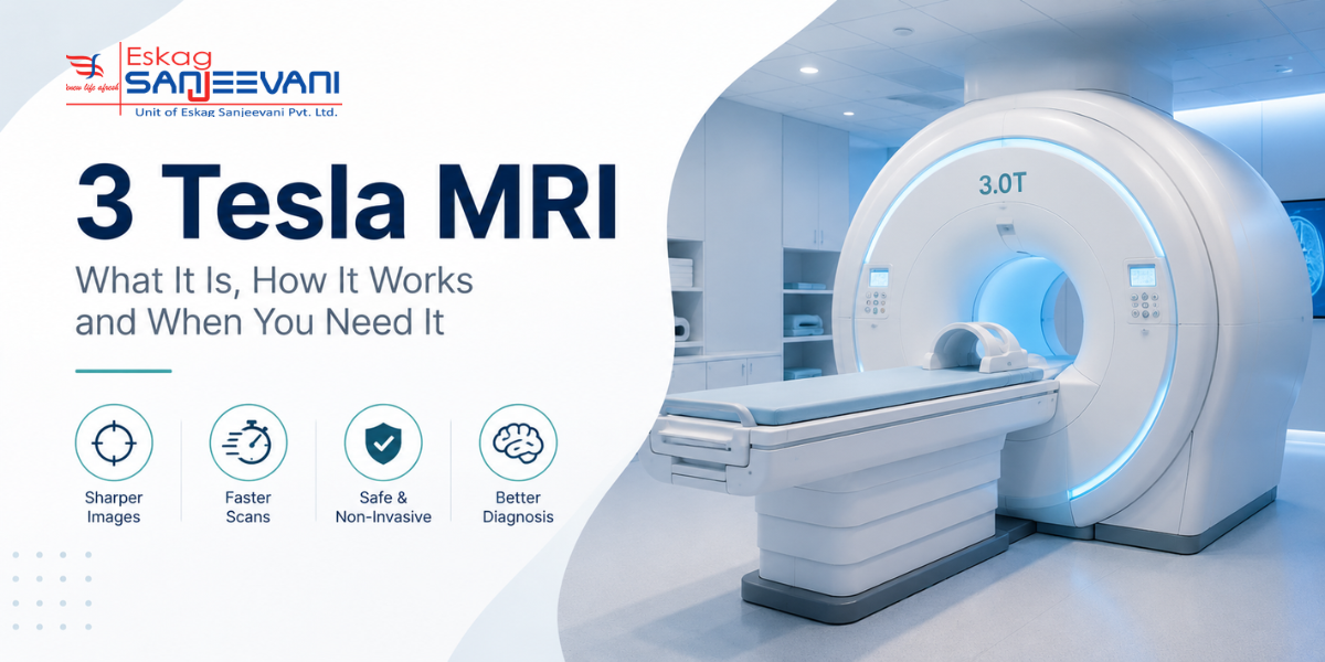 3 Tesla MRI
