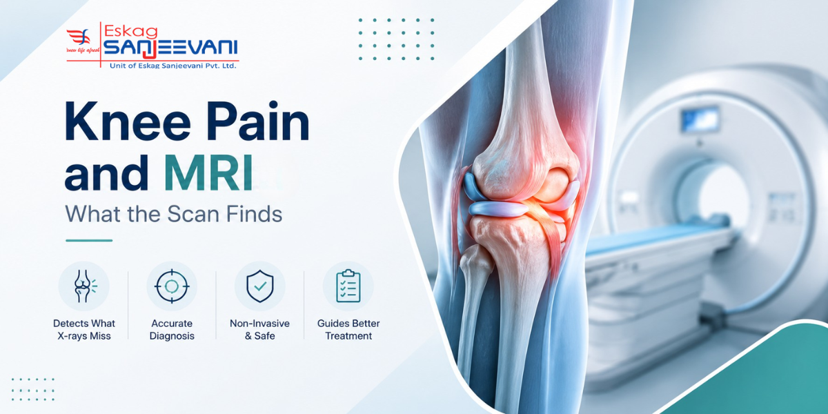 knee pain and mri